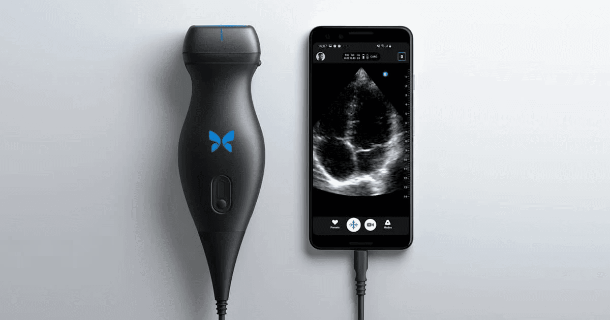 Ultrasound Analysis